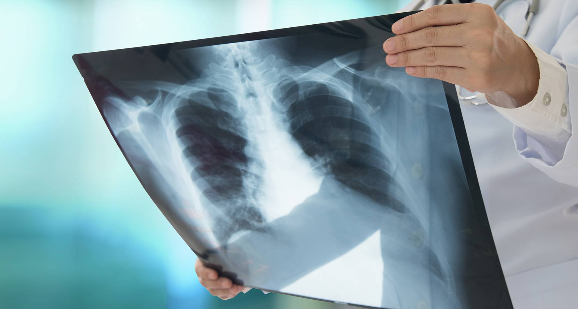 doctor holding up x-ray